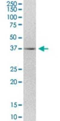 Western Blot: TMEM231 Antibody [H00079583-B01P]