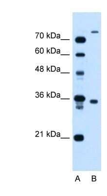 Western Blot: TMEM231 Antibody [NBP1-59823]