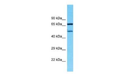 Western Blot: TMEM232 Antibody [NBP2-83686]