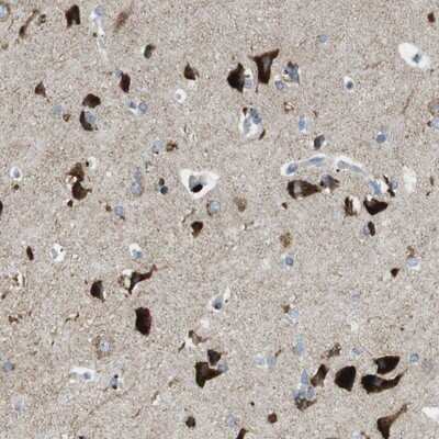 Immunohistochemistry-Paraffin: TMEM234 Antibody [NBP1-90701]