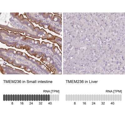 Immunohistochemistry-Paraffin: TMEM236 Antibody [NBP2-62612]