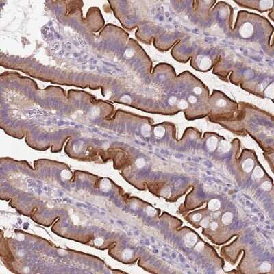 Immunohistochemistry-Paraffin: TMEM236 Antibody [NBP2-62612]