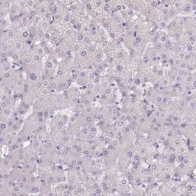 Immunohistochemistry-Paraffin: TMEM236 Antibody [NBP2-62612]