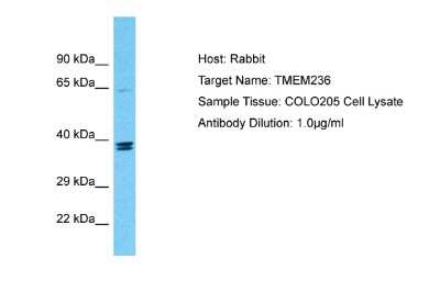 Western Blot: TMEM236 Antibody [NBP2-83687]