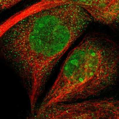 Immunocytochemistry/ Immunofluorescence: TMEM24 Antibody [NBP2-14401]