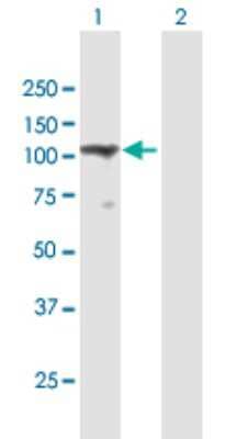 Western Blot: TMEM24 Antibody [H00009854-B01P]