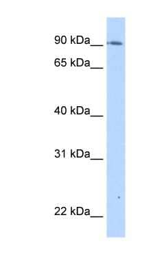 Western Blot: TMEM24 Antibody [NBP1-62475]