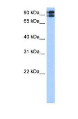 Western Blot: TMEM24 Antibody [NBP1-69582]