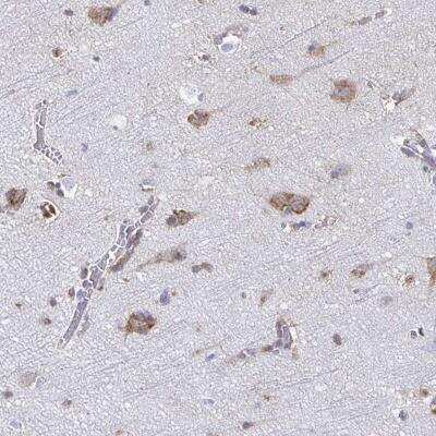 Immunohistochemistry-Paraffin: TMEM241 Antibody [NBP2-32503]