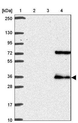 Western Blot: TMEM241 Antibody [NBP2-32503]