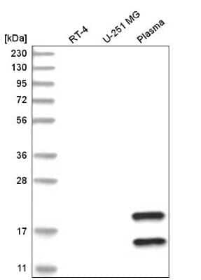 Western Blot: TMEM241 Antibody [NBP2-56668]