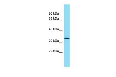 Western Blot: TMEM241 Antibody [NBP2-85946]