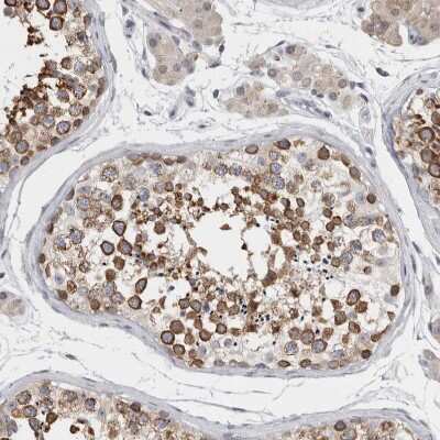 Immunohistochemistry-Paraffin: TMEM242 Antibody [NBP1-88580]