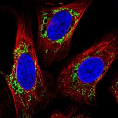 Immunocytochemistry/ Immunofluorescence: TMEM246 Antibody [NBP2-34188]