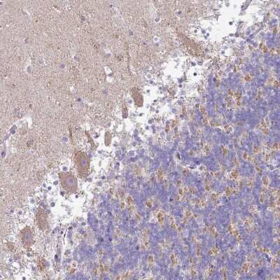 Immunohistochemistry-Paraffin: TMEM246 Antibody [NBP2-34188]