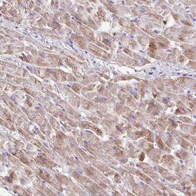 Immunohistochemistry-Paraffin: TMEM246 Antibody [NBP2-34188]