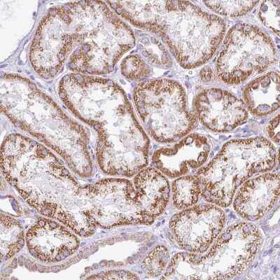 Immunohistochemistry-Paraffin: TMEM246 Antibody [NBP2-34188]