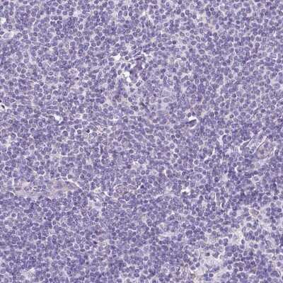 Immunohistochemistry-Paraffin: TMEM246 Antibody [NBP2-34188]