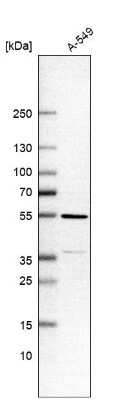 Western Blot: TMEM246 Antibody [NBP2-33702]