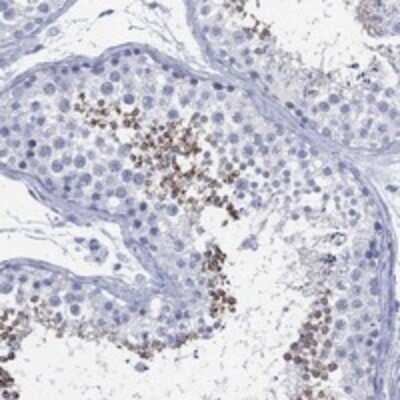 Immunohistochemistry-Paraffin: TMEM247 Antibody [NBP3-17179]