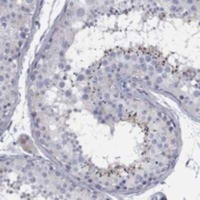 Immunohistochemistry-Paraffin: TMEM249 Antibody [NBP3-17180]