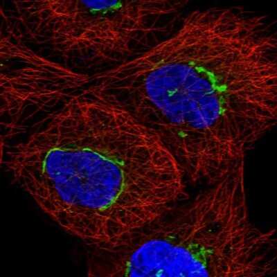 Immunocytochemistry/ Immunofluorescence: TMEM25 Antibody [NBP2-58345]