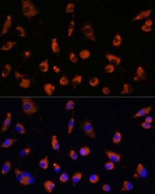 Immunocytochemistry/ Immunofluorescence: TMEM25 Antibody - Azide and BSA Free [NBP2-93836]