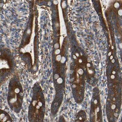 Immunohistochemistry-Paraffin: TMEM25 Antibody [NBP1-82237]