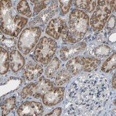 Immunohistochemistry-Paraffin: TMEM25 Antibody [NBP1-82237]
