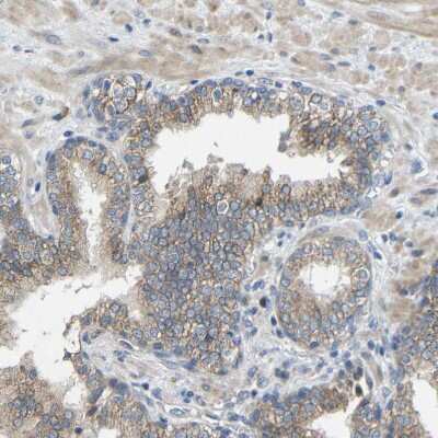 Immunohistochemistry-Paraffin: TMEM25 Antibody [NBP1-82237]