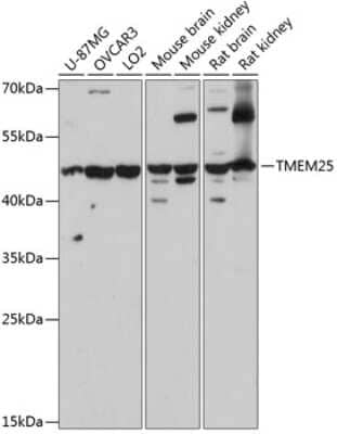 Western Blot: TMEM25 AntibodyAzide and BSA Free [NBP2-93836]