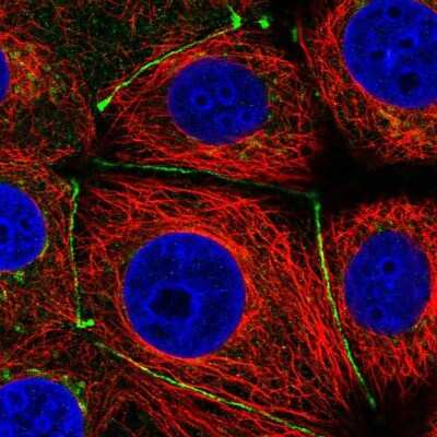 Immunocytochemistry/ Immunofluorescence: TMEM251 Antibody [NBP2-14644]