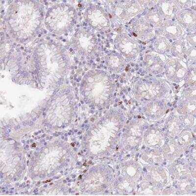 Immunohistochemistry-Paraffin: TMEM251 Antibody [NBP2-14644]