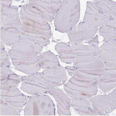 Immunohistochemistry-Paraffin: TMEM251 Antibody [NBP2-14644]