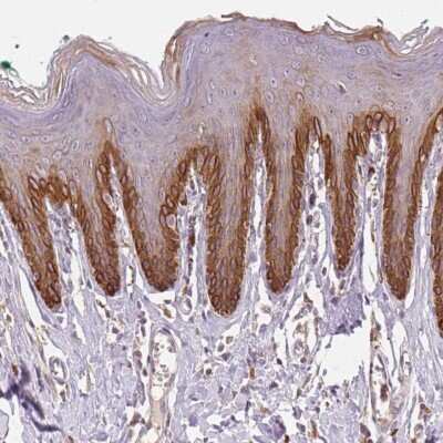 Immunohistochemistry-Paraffin: TMEM253 Antibody [NBP2-49435]