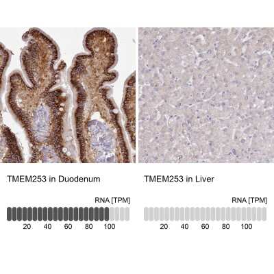 Immunohistochemistry-Paraffin: TMEM253 Antibody [NBP2-14768]