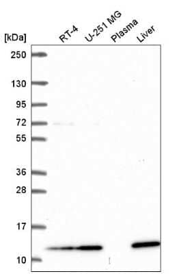 Western Blot: TMEM256 Antibody [NBP2-57645]