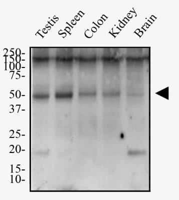 Western Blot: TMEM26 Antibody [NBP2-27334]