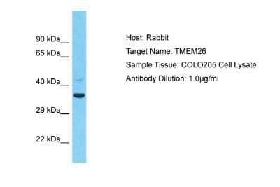 Western Blot: TMEM26 Antibody [NBP2-84305]