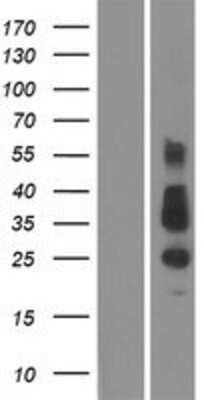 Western Blot: TMEM26 Overexpression Lysate [NBP2-04956]