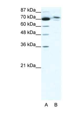 Western Blot: TMEM260 Antibody [NBP1-91525]