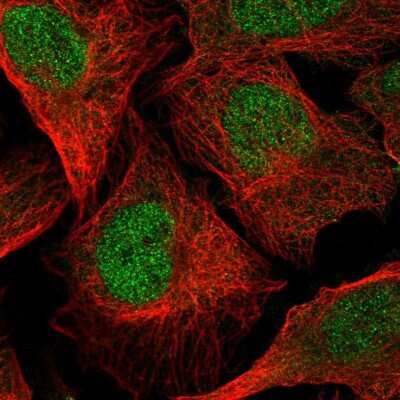 Immunocytochemistry/ Immunofluorescence: TMEM267 Antibody [NBP2-57085]