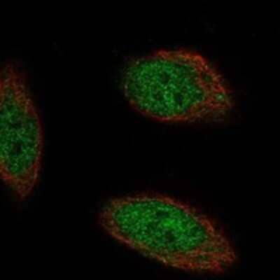 Immunocytochemistry/ Immunofluorescence: TMEM267 Antibody [NBP3-17631]