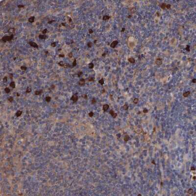 Immunohistochemistry-Paraffin: TMEM268 Antibody [NBP1-90535]