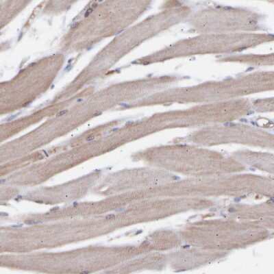 Immunohistochemistry-Paraffin: TMEM268 Antibody [NBP1-90535]