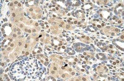 Immunohistochemistry-Paraffin: TMEM30A Antibody [NBP1-59474]