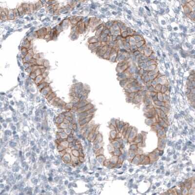 Immunohistochemistry-Paraffin: TMEM30A Antibody [NBP1-86739]