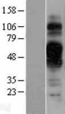 Western Blot: TMEM30B Overexpression Lysate [NBL1-17070]