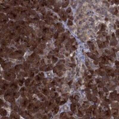 Immunohistochemistry-Paraffin: TMEM33 Antibody [NBP3-17553]