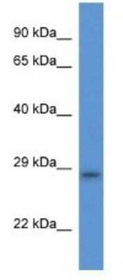 Western Blot: TMEM33 Antibody [NBP1-74217]